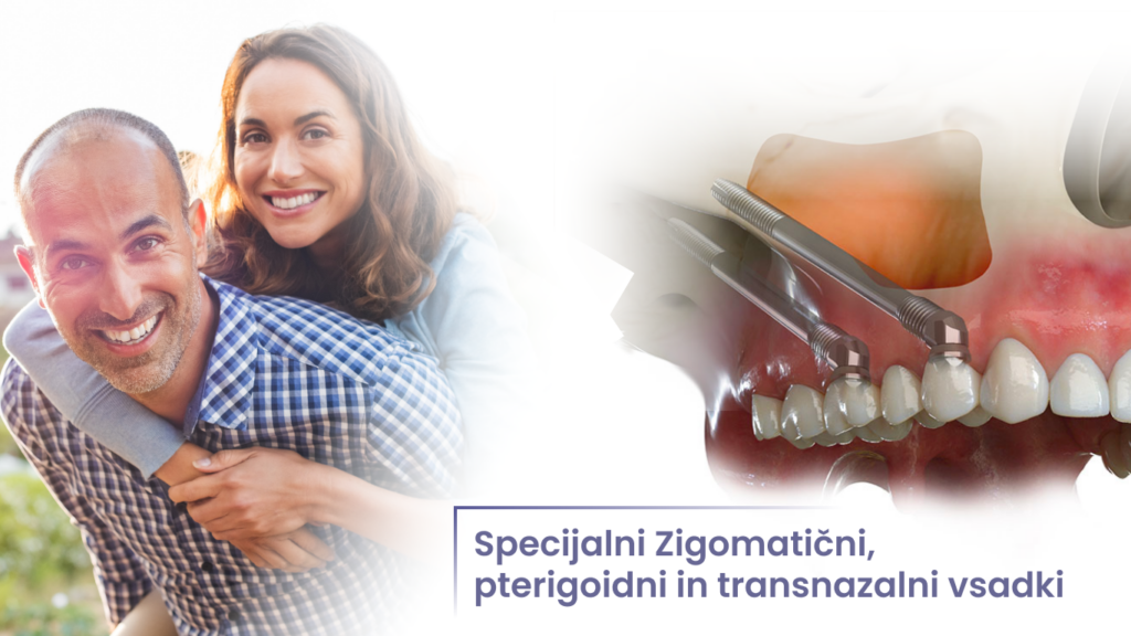 Specijalni Zigomatični, pterigoidni in transnazalni vsadki, vgradnja vsadki, rešitev za brezzobost, all on 4, all on x, all on 6, zobni vsadki