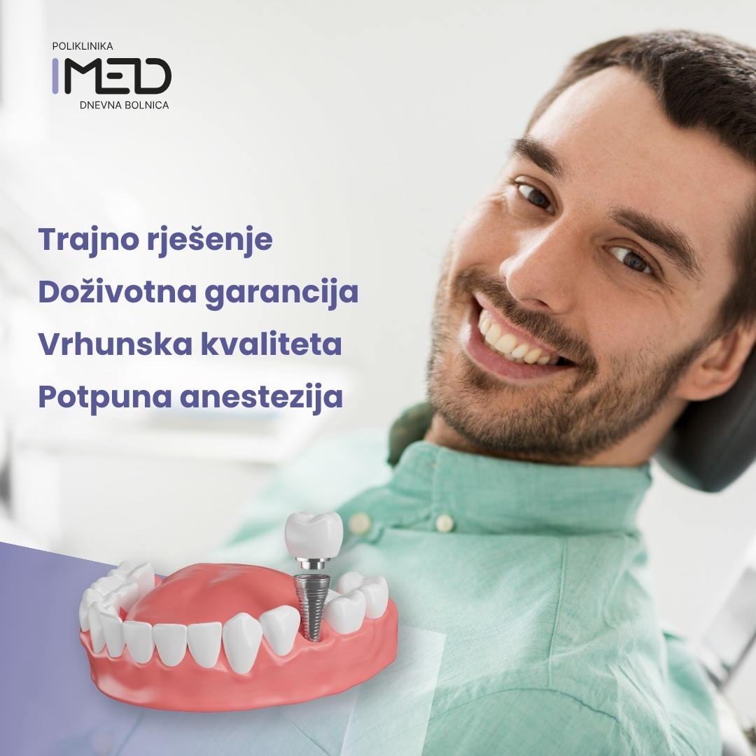zubni implantati cijena, zubni implantati zagreb, cijena zubnih implantata, vrste implantata, implantati cijena