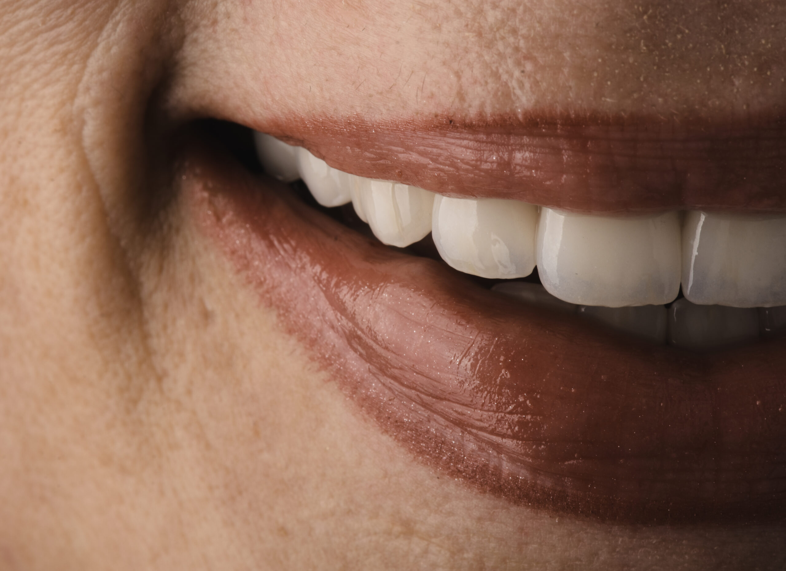 Rad zubnih krunica u poliklinici Imed