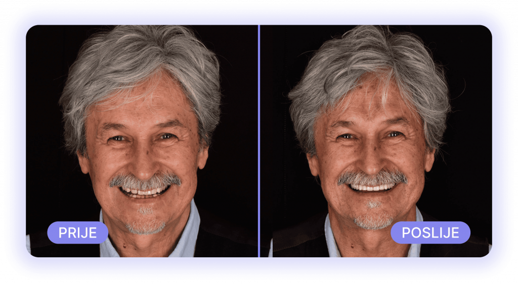 all on 4 - prije poslije rezultati