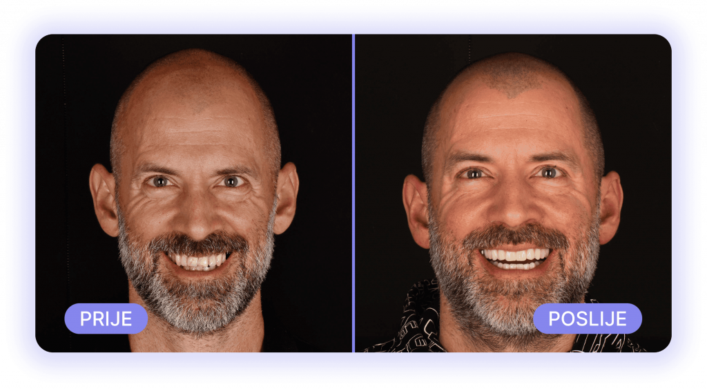 all on 4 - prije poslije rezultati