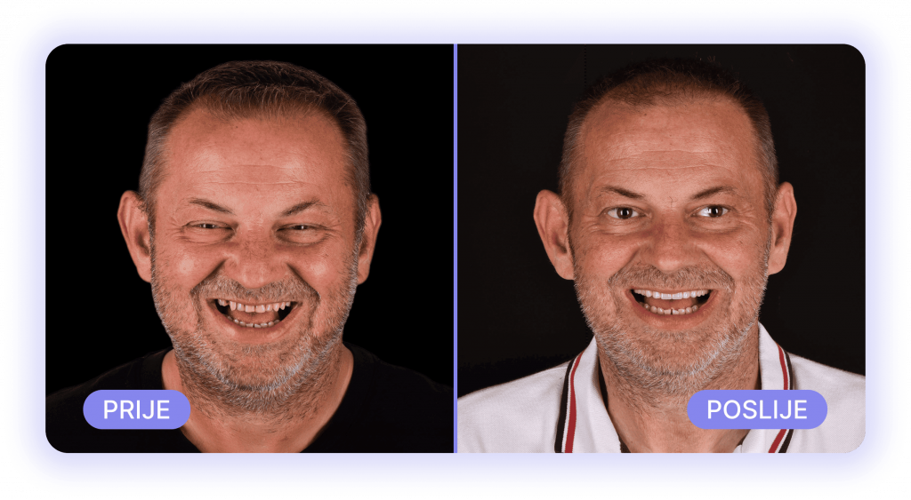 all on 4 - prije poslije rezultati