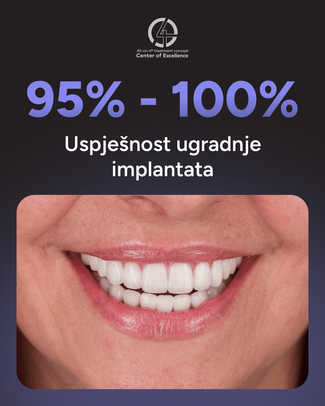 uspjesnost ugradnje implantata